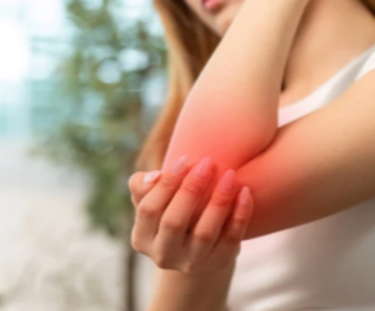 Tutore al gomito: come sceglierlo?